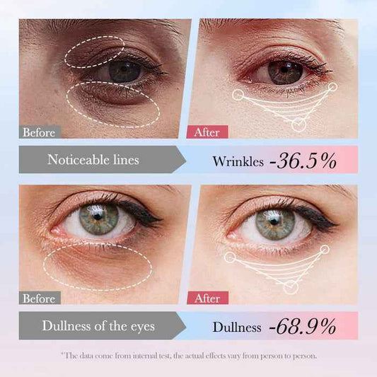 SADOER Eye Cream 4 in 1 Roll-on Moisturizing Serum for Dark Circles, Eye Bags, and Firming