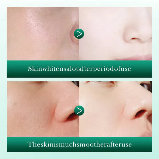 SADOER Retinol Anti-Wrinkle Serum with Centella for Soothing Facial Moisturization 40ml - MAT Beauty