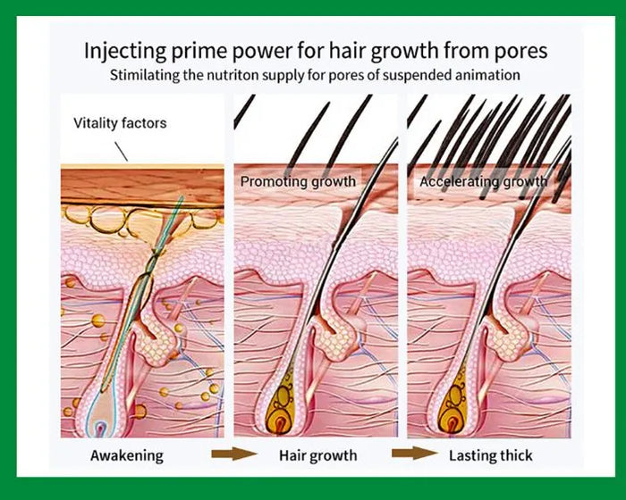 Aichun Beauty Ginger Hair Shampoo 200ml for Healthy Hair in 7 Days - MAT Beauty