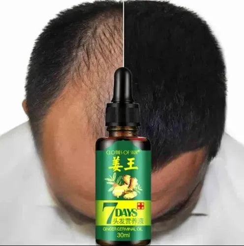 Aichun Beauty Ginger Hair Growth Oil Serum for Damaged Hair Treatment - 30ml - MAT Beauty