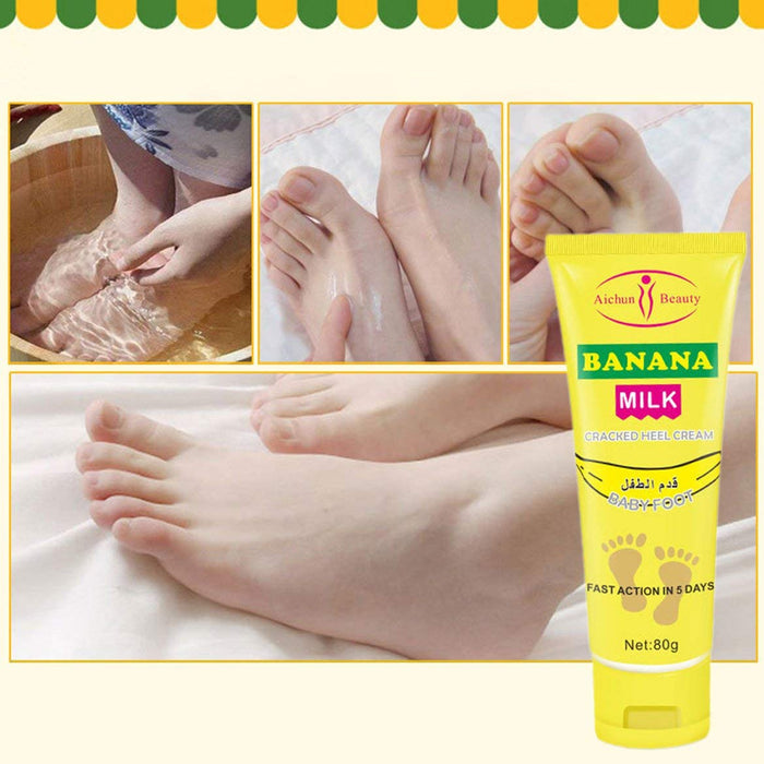 Aichun Beauty Banana Heel Cream for Cracked Heel Repair - MAT Beauty