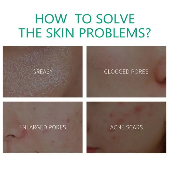 Aichun Beauty Eight Pack Abdominal Oil for Weight Loss - Strong Belly Burning Muscle Fat Remover and Skin Renewal Slimming Oil for Men - MAT Beauty