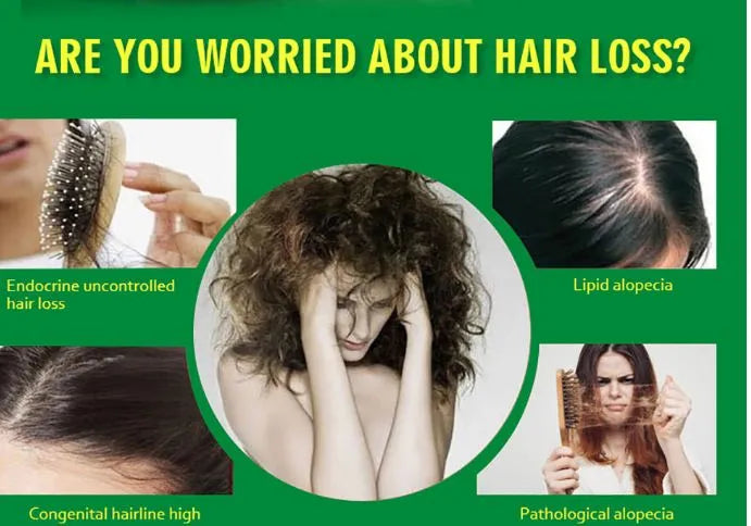 Aichun Beauty Ginger Hair Growth Oil Serum for Damaged Hair Treatment - 30ml - MAT Beauty