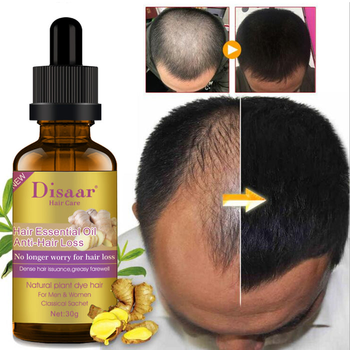 Disaar Ginger Hair Care for Men and Women - Powerful Hair Growth Solution 30ML - MAT Beauty