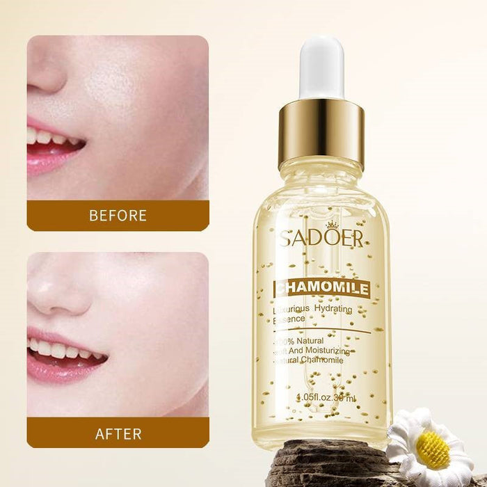SADOER Chamomile Whitening Face Serum - Moisturizing 30ml - MAT Beauty