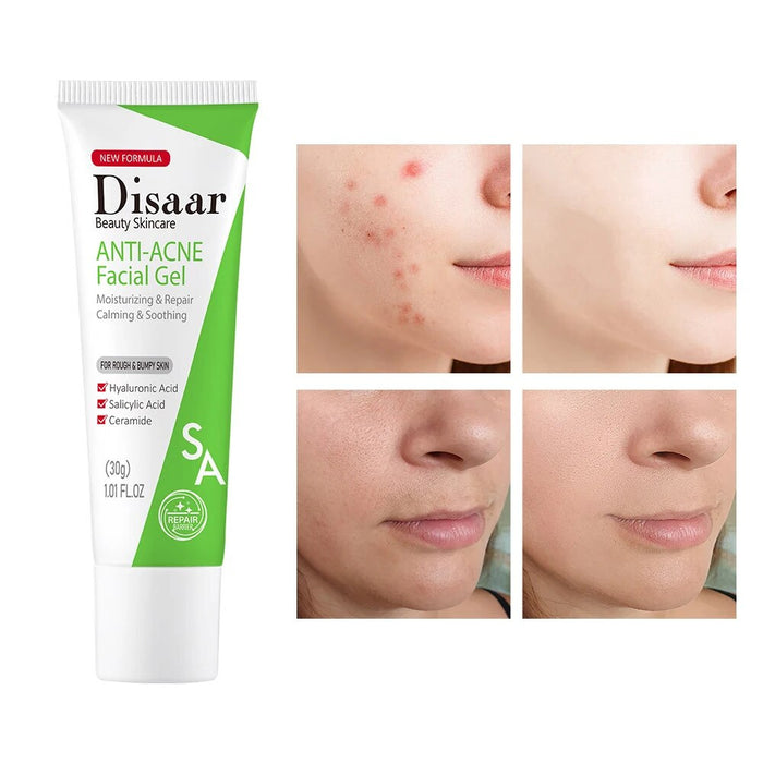 Disaar Ceramide Anti-Acne Gel - Moisturizing Facial Treatment 30g - MAT Beauty