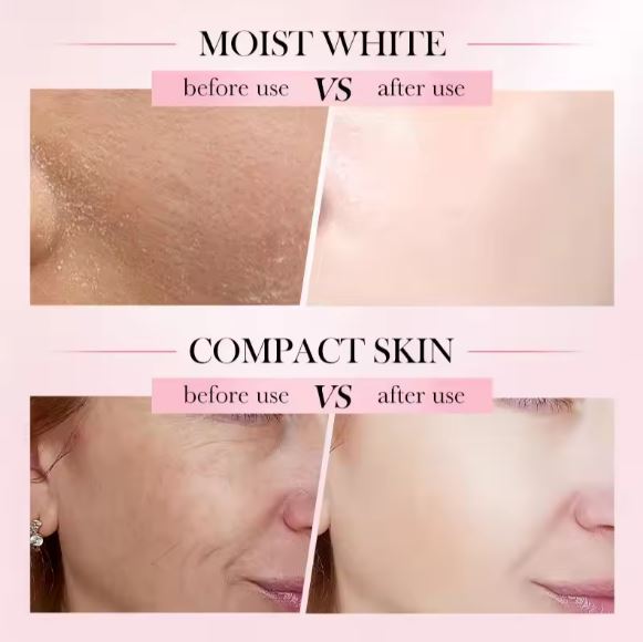 Sadoer Hyaluronic Acid Face Cream - 4 In 1 Whitening, Nourishing, Firming, Anti-Wrinkle with Vitamin C and E - MAT Beauty