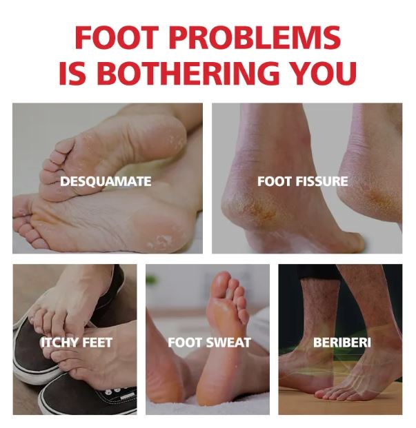 Aichun Beauty Moisturizing Foot Cream for Cracked Heels, Dead Skin Care Removal Cream, 20G - MAT Beauty