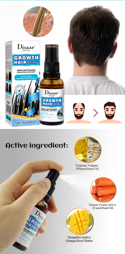 Vegan Ginseng Hair Growth Spray - Natural 30ml Anti-Hair Loss Solution - MAT Beauty