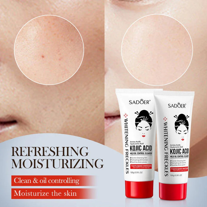 Sadoer Oil Control Cleanser with Amino Acids, Hyaluronic Acid, and Kojic Acid - MAT Beauty