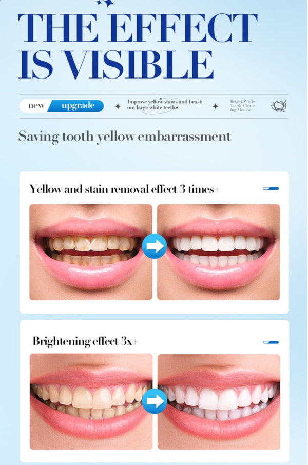 SADOER Teeth Whitening Mousse - Mint Fresh Breath Tooth Cleaning Toothpaste 60ml - MAT Beauty