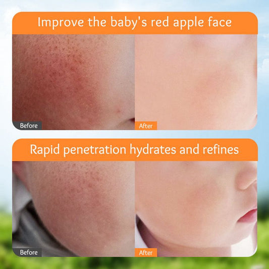 SADOER Children's Calendula Cream - Moisturizing & Hydrating Formula 50g - MAT Beauty