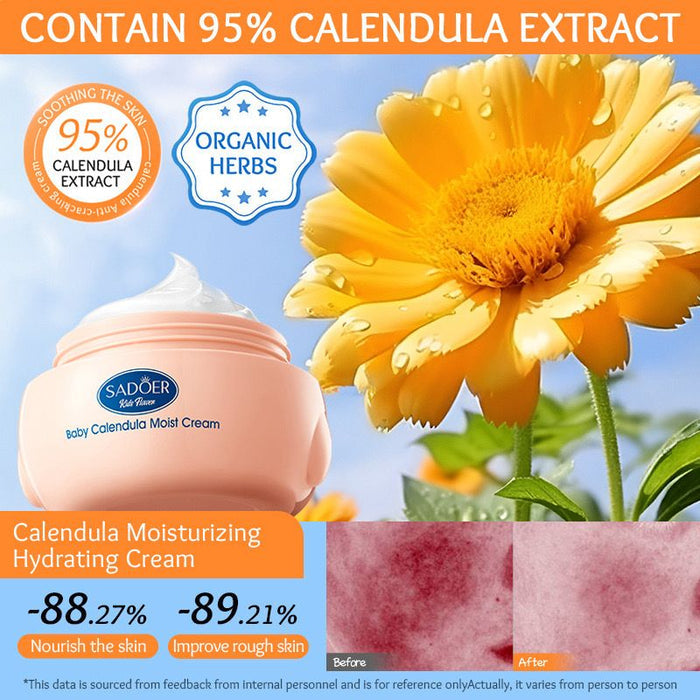 SADOER Children's Calendula Cream - Moisturizing & Hydrating Formula 50g - MAT Beauty