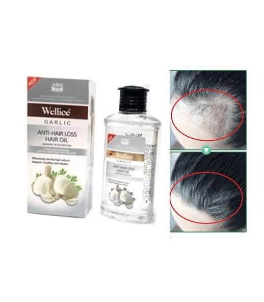 Wellice Garlic Hair Oil 150ml - Anti-Hair Loss Treatment - MAT Beauty