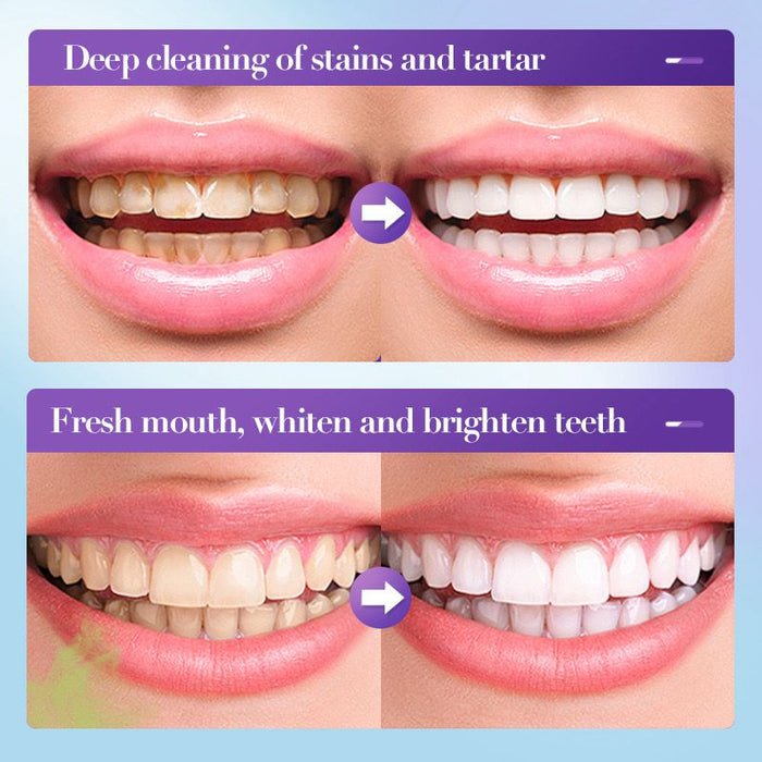 Sadoer V34 Whitening Toothpaste with Fresh Flavor 28ml Toothpaste - MAT Beauty