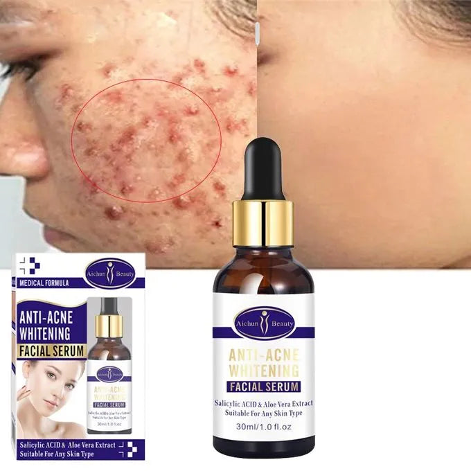 Aichun Beauty Scar Removal Serum - 30ML Glowing Remover for Scars - MAT Beauty