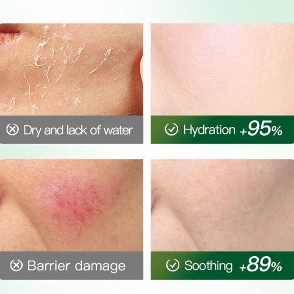 Sadoer Pineapple Moisturizing Facial Mask Sheet - Antioxidant Benefits for Glowing Skin - MAT Beauty