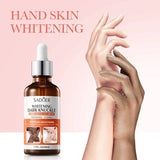 Sadoer Melanin Removal Serum for Dark Skin Lightening & Whitening Body Care Oil 50ml - MAT Beauty