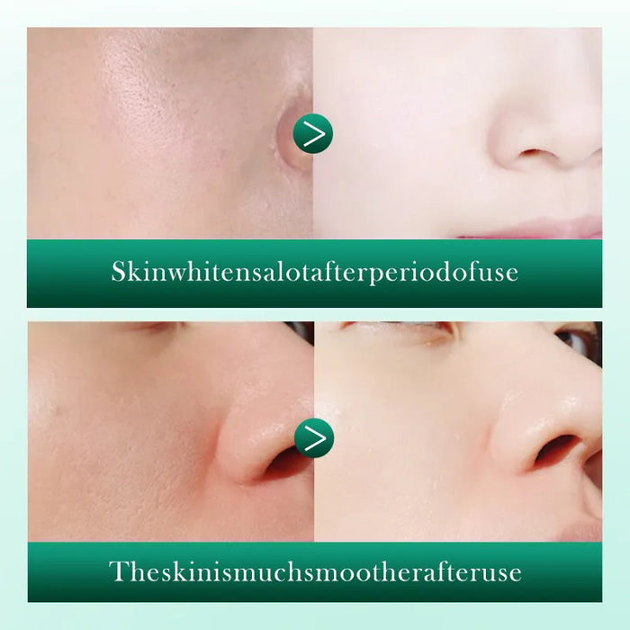 SADOER Retinol Anti-Wrinkle Serum with Centella for Soothing Facial Moisturization 40ml - MAT Beauty