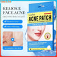 Sadoer Salicylic Acid Acne Patch for Invisible Pimple Repair and Clearer Skin - MAT Beauty