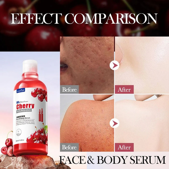SADOER Cherry Smooth Skin Serum for Glowing Face & Body - MAT Beauty